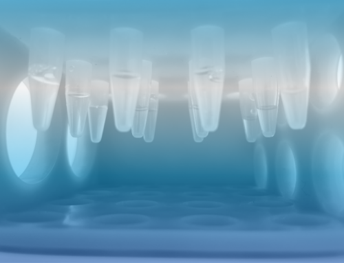 Kappa-free light chains in cerebrospinal fluid for the diagnosis of multiple sclerosis