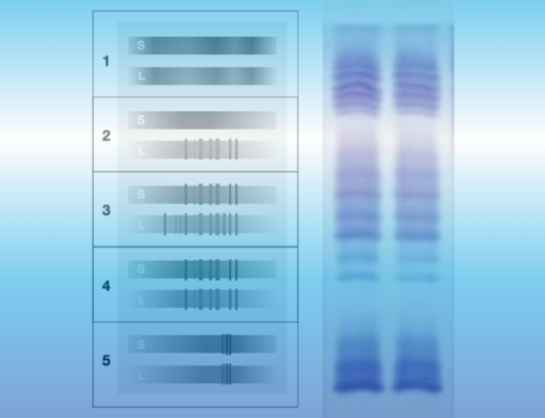 Oligoclonal bands: Quality control for IgG-specific oligoclonal bands