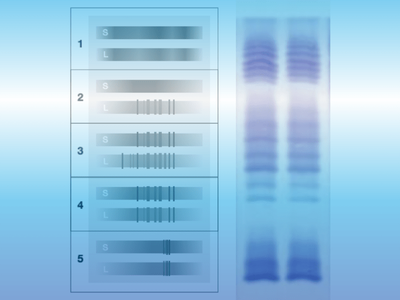 Oligoclonal bands: Quality control for IgG-specific oligoclonal bands